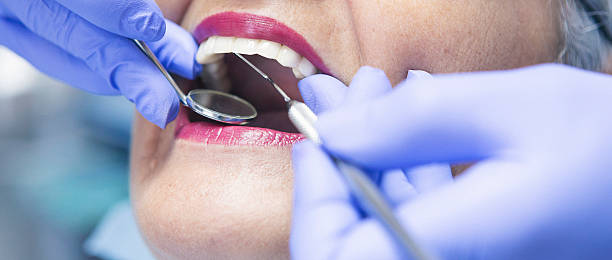 Best Emergency Tooth Extraction in Teays Valley, WV